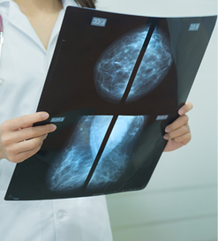 Breast lipoma – causes, symptoms, treatment